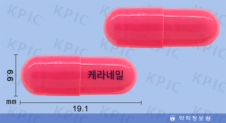 식별 이미지